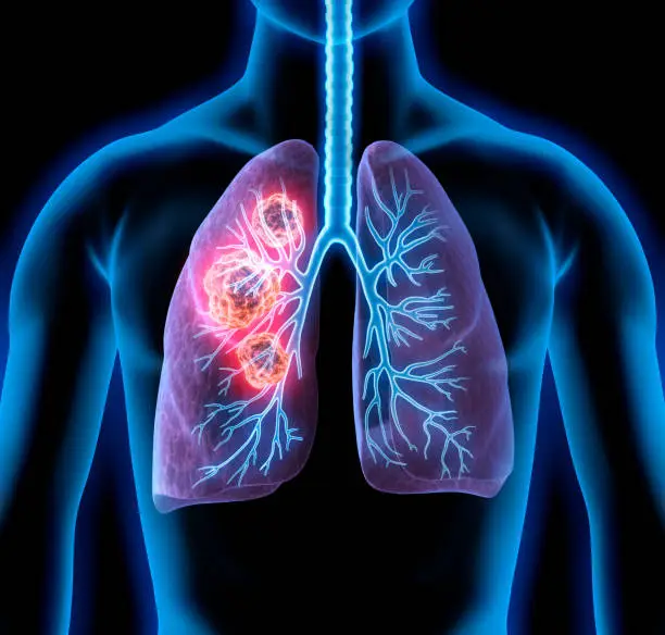 immune system