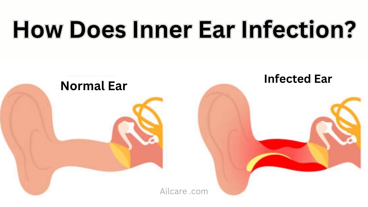 How Does Inner Ear Infection